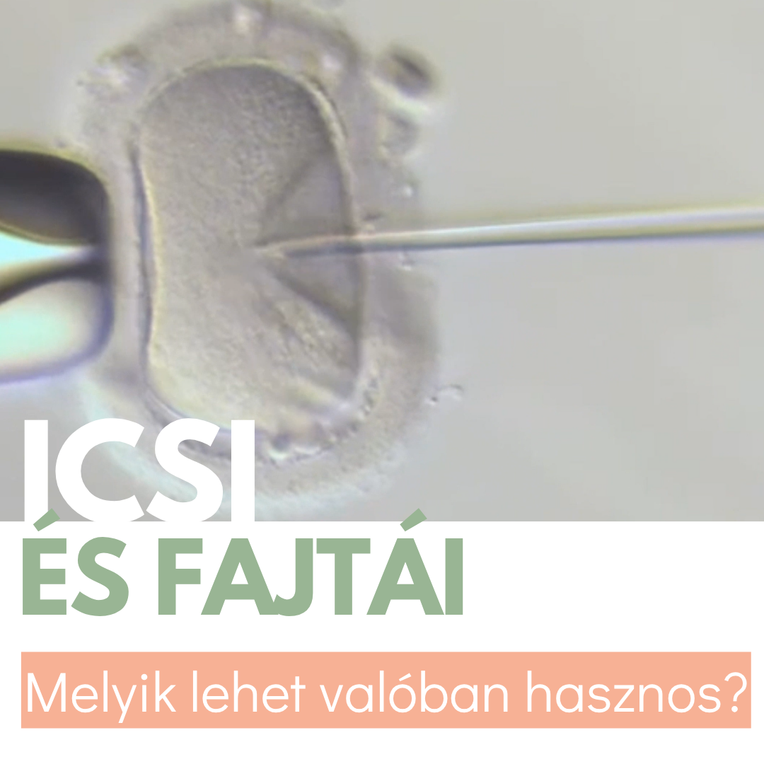 icsi ivf