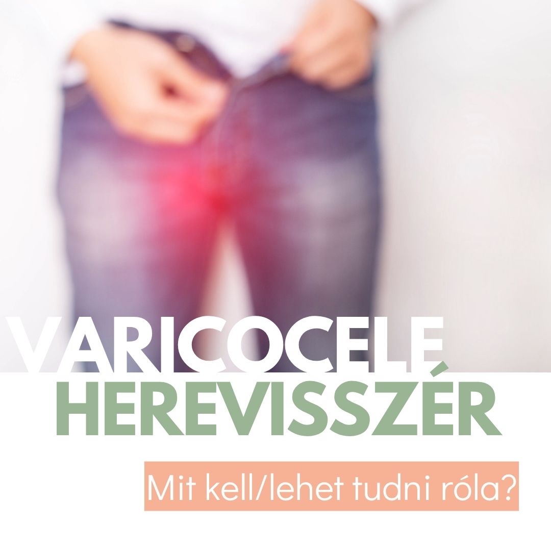 férfi meddőség, herevisszér, spermium minőség, varicocele műtét, mikrosebészeti varicocelectomia, oxidatív stressz